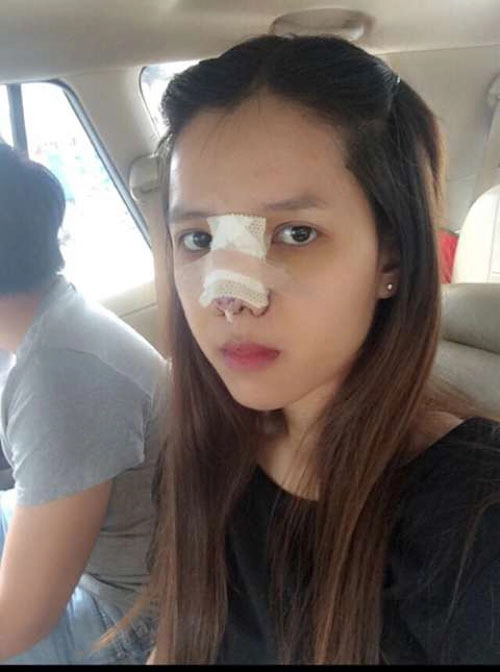 9x việt chi nửa tỉ phẫu thuật thành hot girl vì bị chê xấu - 6