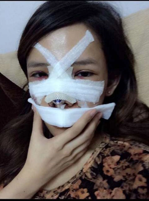 9x việt chi nửa tỉ phẫu thuật thành hot girl vì bị chê xấu - 7