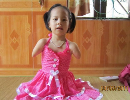 Bé không tay chân khát khao gặp nick - 3