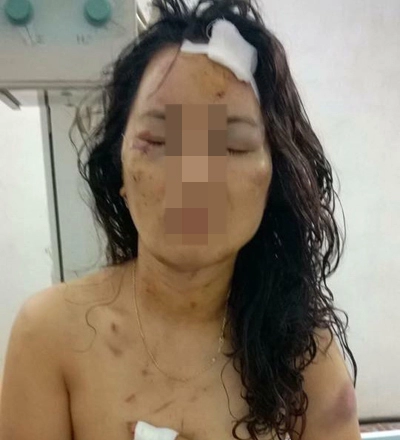 Cô giáo bị chồng cũ bạo hành tàn độc như thời trung cổ - 1