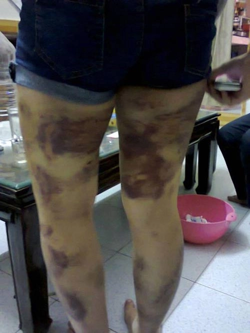 Nhức nhối những vụ cha mẹ đánh con - 2