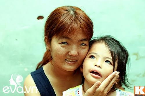 ám ảnh đôi mắt xanh ngọc bí ẩn của 2 đứa trẻ lớn lên từ khu ổ chuột sài gòn - 4