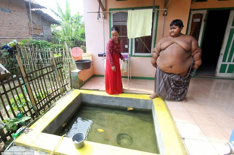 Hình ảnh khó tin trước và sau 8 năm của cậu bé béo nhất thế giới - 2