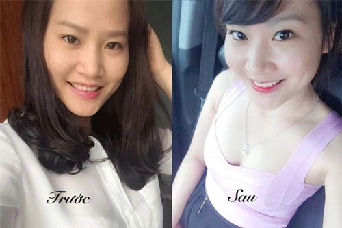 Biết hết 7 công dụng này của oxy già 99 chị em chạy đi mua chúng ngay lập tức - 4