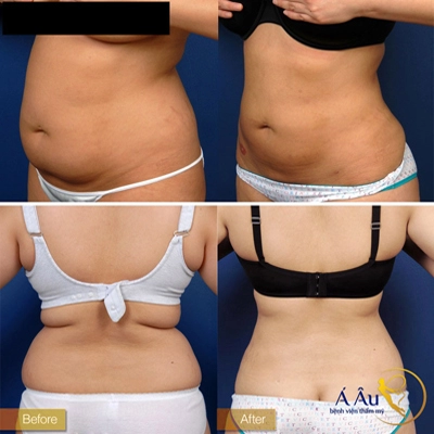 Cơ thể thon gọn tự tin diện bikini