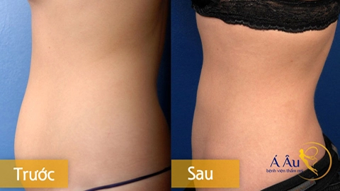 Cơ thể thon gọn tự tin diện bikini