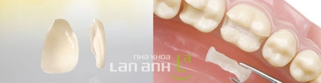 Công nghệ hiện đại đem lại nụ cười như ý