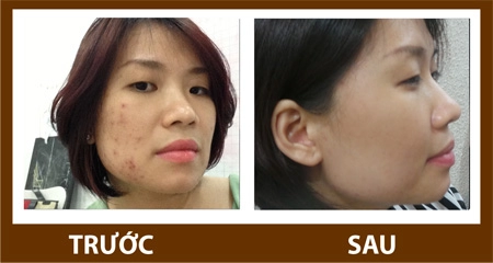 Đẹp bất ngờ với tảo silic sống