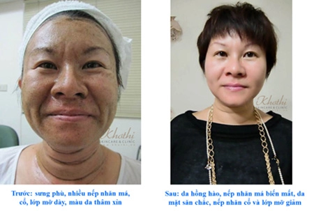 Đẹp bất ngờ với tảo silic sống