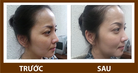 Đẹp bất ngờ với tảo silic sống