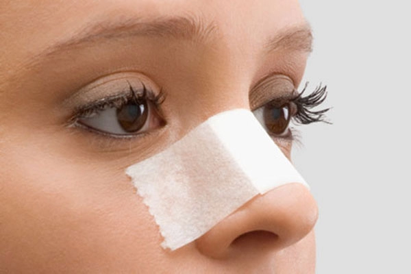 Những biến chứng khi nâng mũi bằng sụn tai