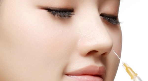 Những biến chứng khi nâng mũi bằng sụn tai