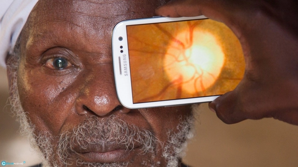 Ứng dụng khám mắt chuyên nghiệp peek retina