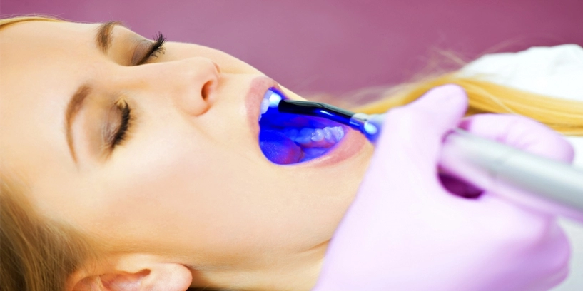Tẩy trắng răng coi chừng thành hại răng
