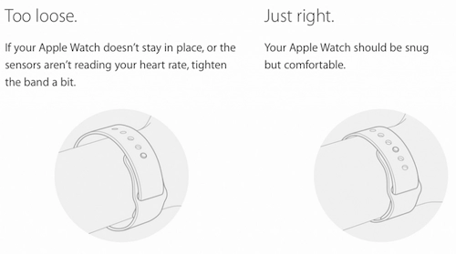 Bị dị ứng do đeo apple watch