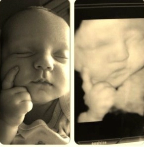 Hình ảnh của bé khi siêu âm và lúc đã chào đời