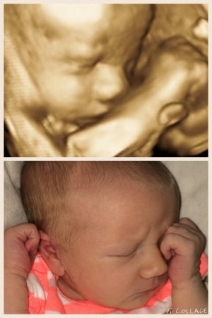 So sánh các bé khi siêu âm và lúc chào đời
