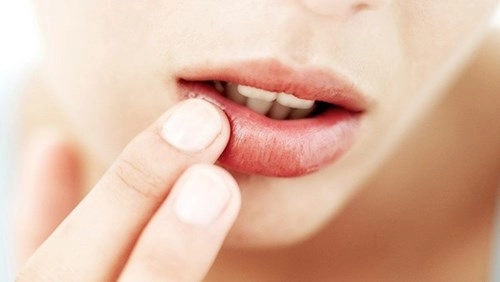 Tật xấu dễ mắc khiến bạn sở hữu đôi môi vừa viêm vừa xấu