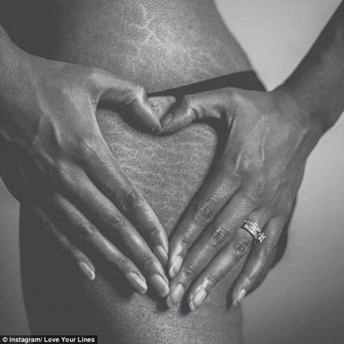 Bật khóc với những hình ảnh biết nói về cơ thể người mẹ sau sinh