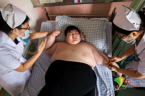 Cậu bé 14 tuổi nặng 300kg vì sức ăn kinh khủng