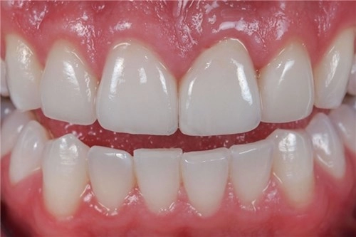 Hiểu 1001 sự thật về răng miệng sẽ giúp bạn tỏa sáng như nữ thần