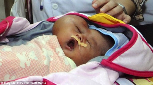 Những bé sơ sinh kỳ lạ khiến y học thế giới kinh ngạc