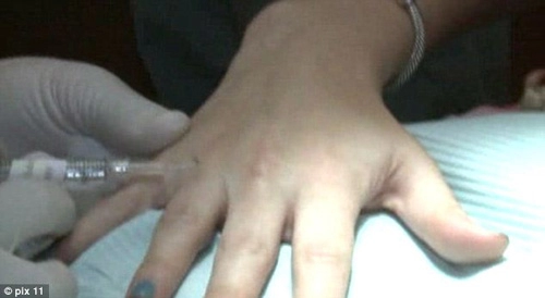 Rộ mốt phẫu thuật ngón tay đeo nhẫn cưới