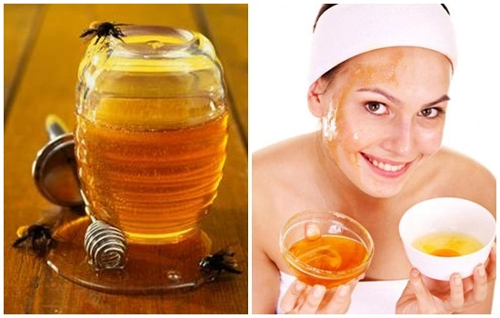 3 cách trị tàn nhang bằng mật ong hiệu quả nhanh