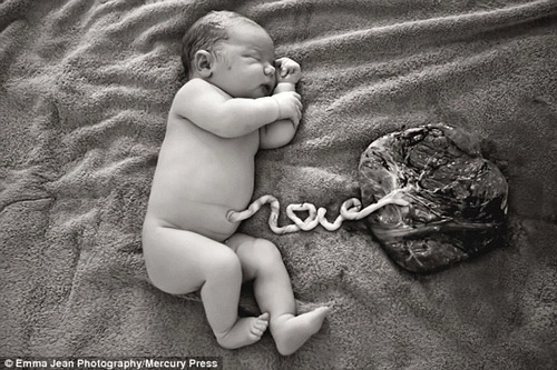 Ảnh bé mới sinh có dây rốn hình chữ love gây sốt mạng