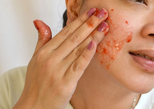 Da sạch mịn với mặt nạ dâu tây
