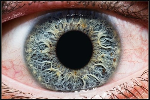 Đây là ý nghĩa của chấm đen trên mống mắt hãy kiểm tra ngay