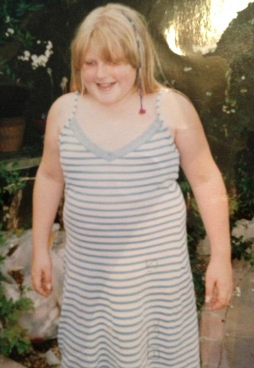 Hành trình cân nặng bất thường của cô gái béo phì