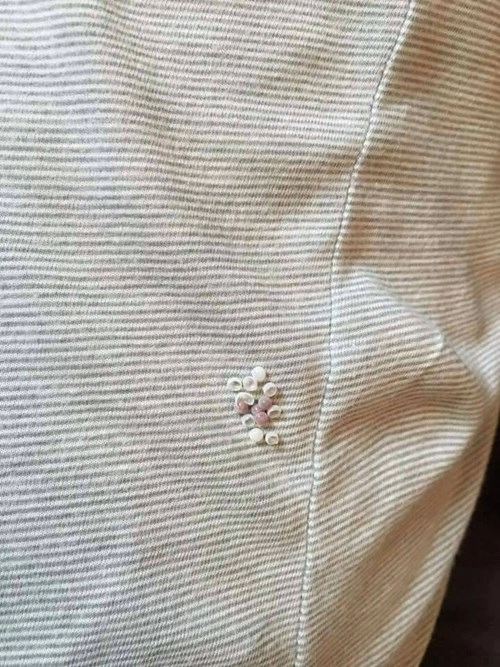 Nếu thấy những hạt nhỏ này khi rút quần áo thì hãy cẩn thận