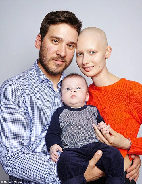 Người mẫu ung thư chấp nhận xấu xí để sinh con