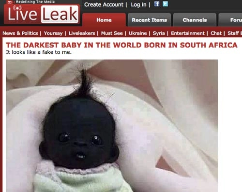Sự thật gây sốc về em bé nam phi đen nhất thế giới