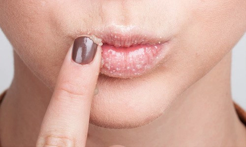 4 giải pháp đặc trị đôi môi đầy nếp nhăn
