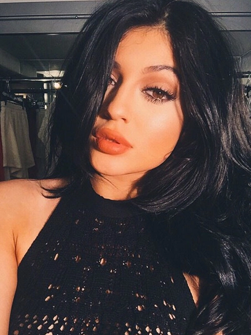 Em gái 17 tuổi của kim kardashian thừa nhận bơm môi