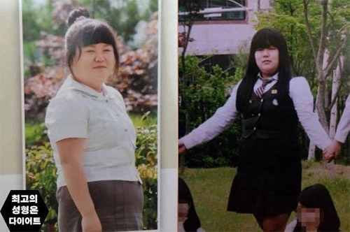 Thiếu nữ béo phì xinh đẹp như hot girl nhờ giảm cân