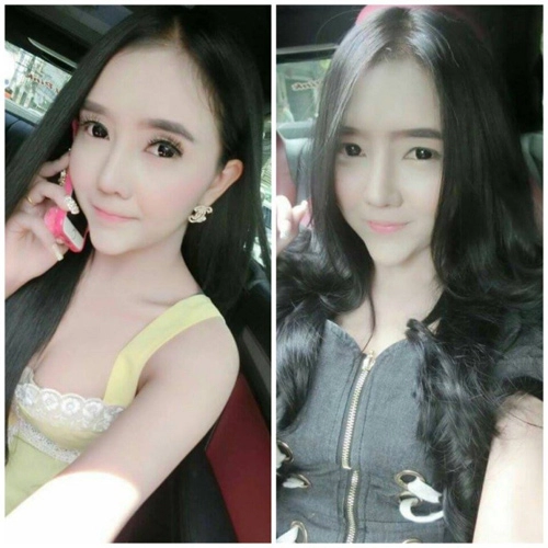 Thiếu nữ đen đúa hóa hot girl trắng ngần nhờ dao kéo