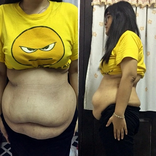 Kỳ tích cô béo 12 tạ giảm 45 kg trong 3 tháng