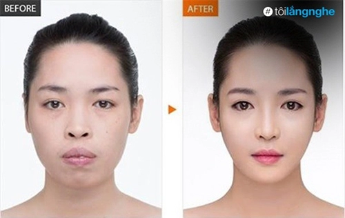 Cuộc đời sang trang của cô gái lột xác nhờ phẫu thuật thẩm mỹ