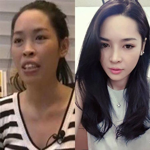 Cuộc đời sang trang của cô gái lột xác nhờ phẫu thuật thẩm mỹ