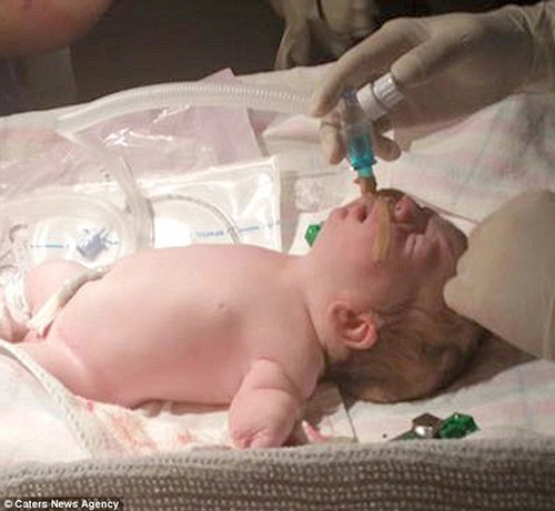 Em bé kỳ lạ 3 lần được báo đã chết trong bụng mẹ vẫn sống sót