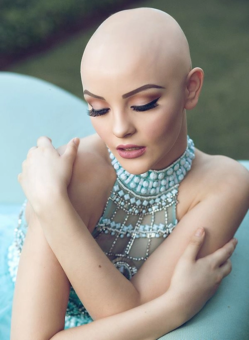 Cô gái 17 tuổi bị ung thư vẫn đầy nghị lực để lột xác xinh đẹp