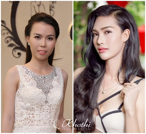 Khơ thị chính thức khởi động chương trình perfect beauty 2016