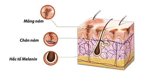 Melanin kẻ thù của làn da