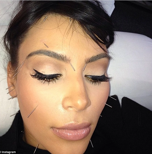 Kim kardashian khoe mặt đầy kim châm