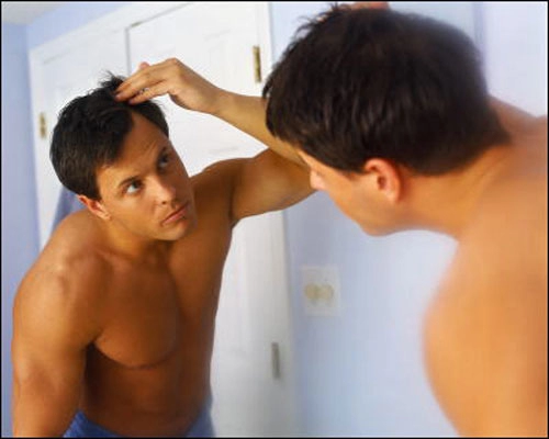 4 nguyên nhân khiến nam giới hói đầu