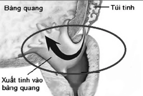 Cách giữ lửa yêu ở người đái tháo đường