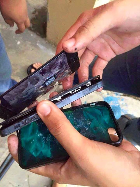 Iphone 5 phát nổ nam thanh niên bị bỏng nặng